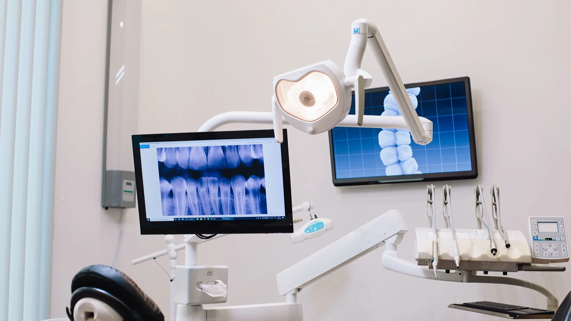 Lo studio: la radiografia e i denti in 3D sugli schermi, la lampada che si accende